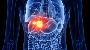 Biomarker-liver-tumors
