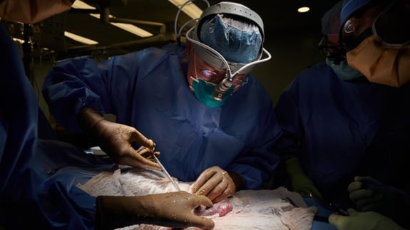 Surgeons at New York University transplanted pig kidneys into legally dead people
