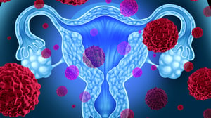 Uterus or uterine cancer medical concept as cancerous cells in a female body